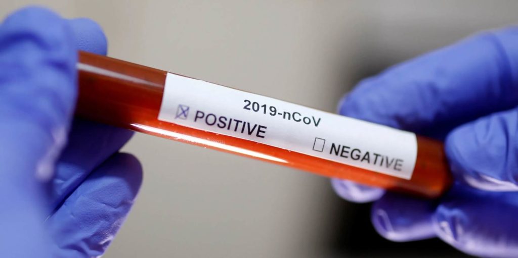 κορονοϊός-συναγερμός-στην-σκύδρα-κλ-1104000