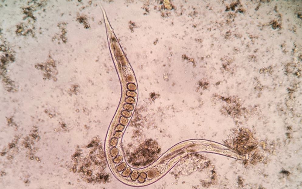 η-φαγούρα-που-επεκτεινόταν-σε-όλο-του-τ-1437105