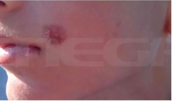 επιχείρησε-να-βάλει-το-αναμμένο-τσιγ-1888565