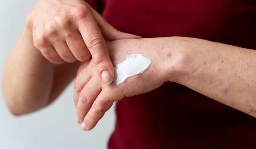 εοφ-ανακαλούνται-παρτίδες-κρέμας-για-1911169