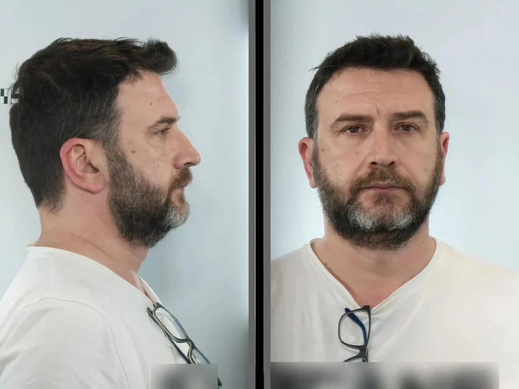 αυτός-είναι-ο-ταξιτζής-που-λήστευε-πελ-2042333