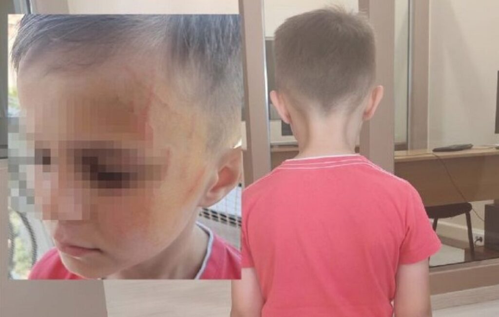 σοκ-στο-αγρίνιο-πεντάχρονοι-έδειραν-σ-2107936