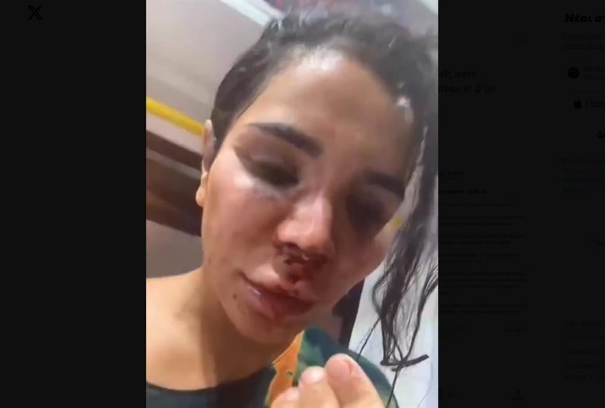 εφιαλτικές-στιγμές-έζησε-30χρονη-influencer-δι-2123711