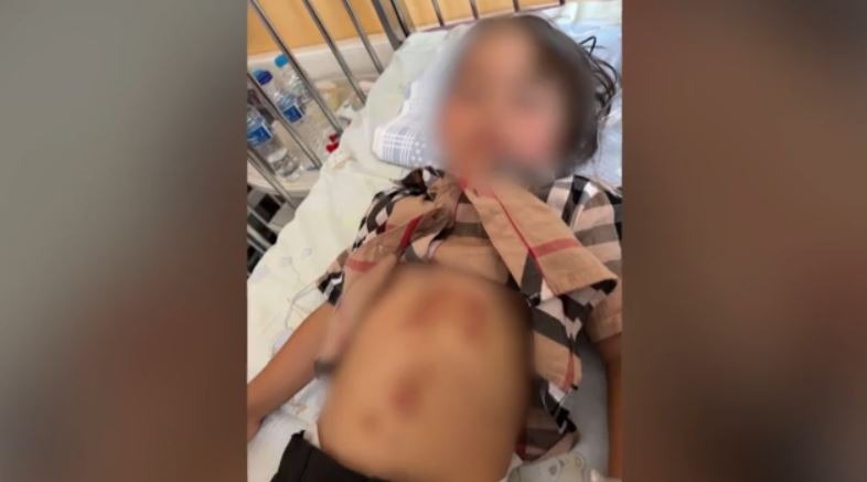 χαλκιδική-βίντεο-με-τον-λύκο-που-επιτέ-2165399