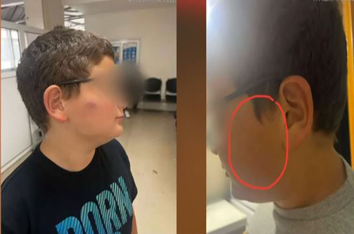 χτύπησαν-με-μπουνιές-στο-κεφάλι-11χρονο-2184433