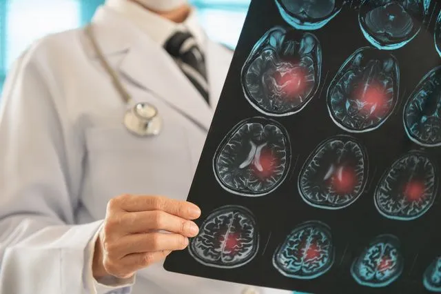 από-ποιες-παθήσεις-πεθαίνουν-πιο-συχν-2286307