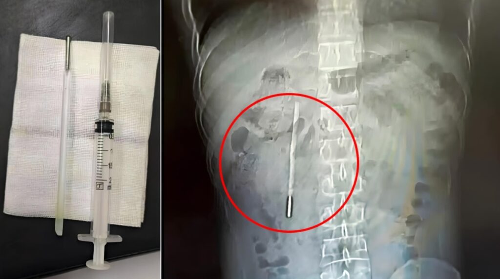 κίνα-άνδρας-ζούσε-επί-20-χρόνια-με-ένα-θ-2304173